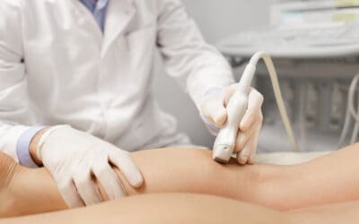 The Benefits of Sclerotherapy