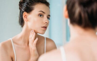 What Causes Facial Veins?