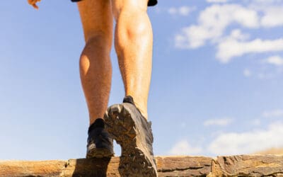 Treatment Options for Your Varicose Veins