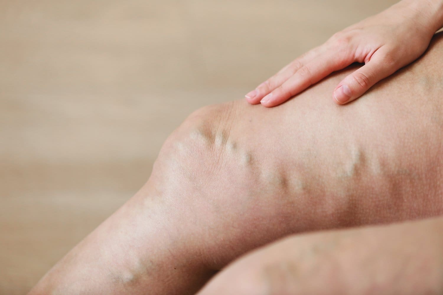 Vein Health | Vein Pain | Leg Pain | Heart Health Awareness Month