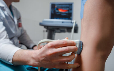 Vein Ultrasound: Understand the Procedure, Benefits, and Outcomes